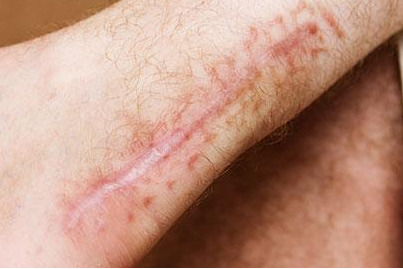  عکس دخـتر تو برف برای پروفایـل