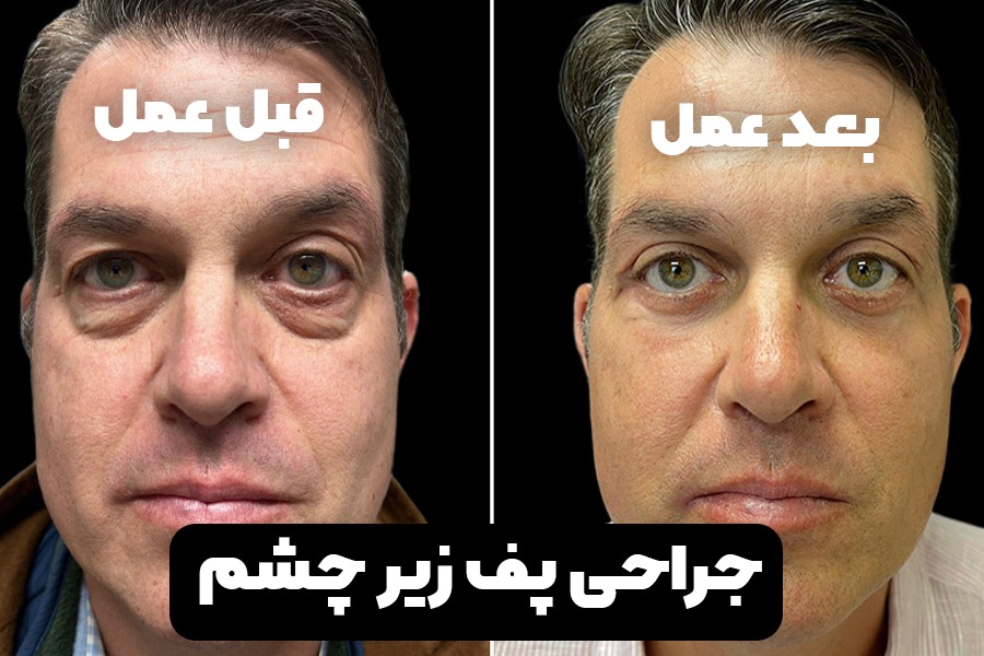 عکس خفن استوری تولد اردیبهشت ماهی