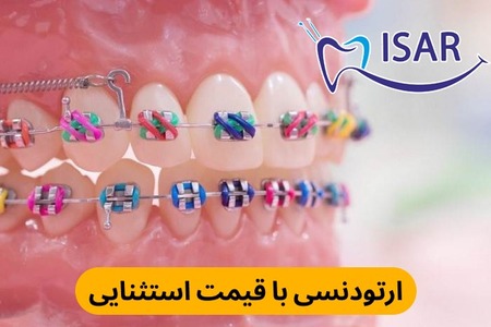 عکس عاشقانه خارجی زشت